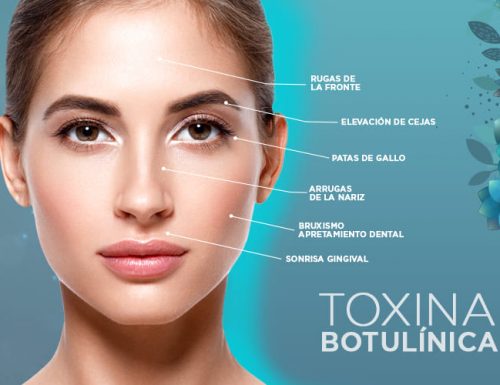 Aplicación De Toxina Botulínica Dr Alfonso Meza Neurólogo 5850